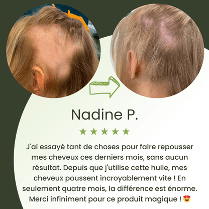 Sérum de croissance pour cheveux (60ml)